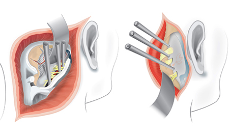Full Color Illustration