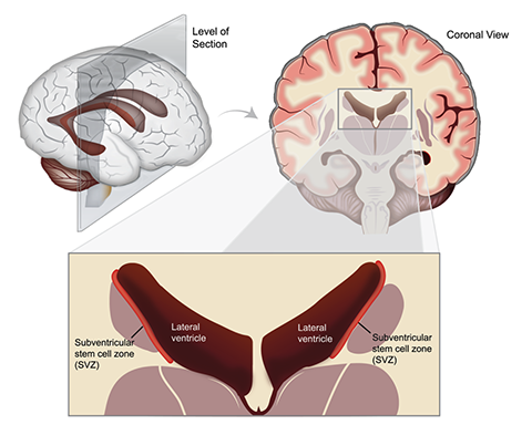 Medical Image